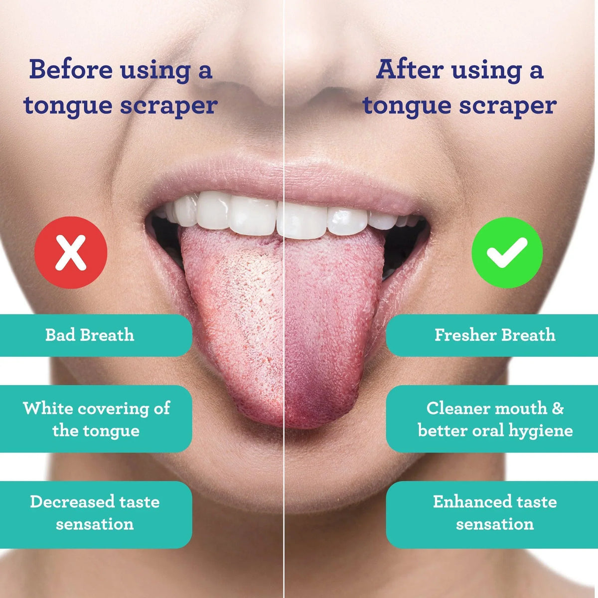 U Shaped Stainless Steel Tongue Scraper – 2 Pack